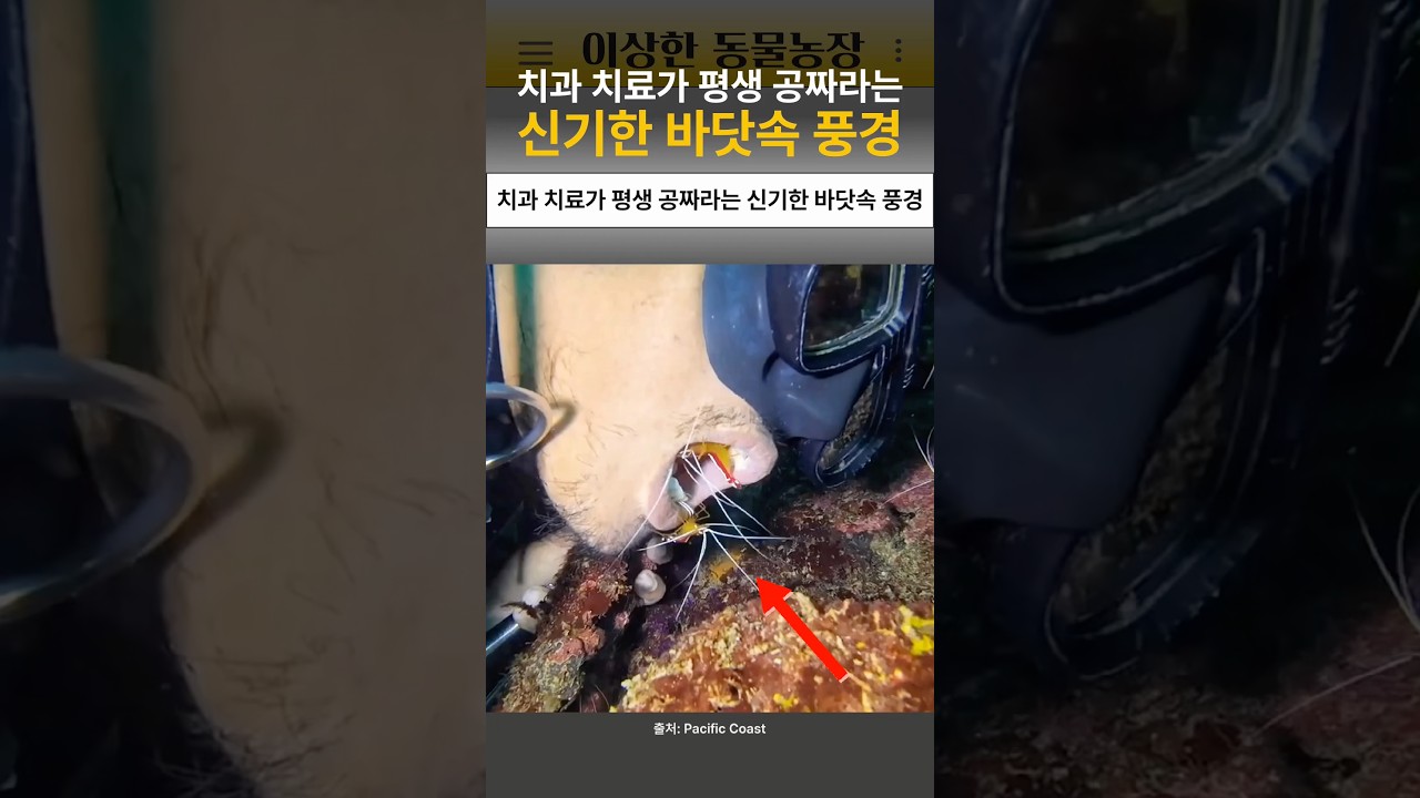 치과 치료가 평생 공짜라는 신기한 바닷속 풍경