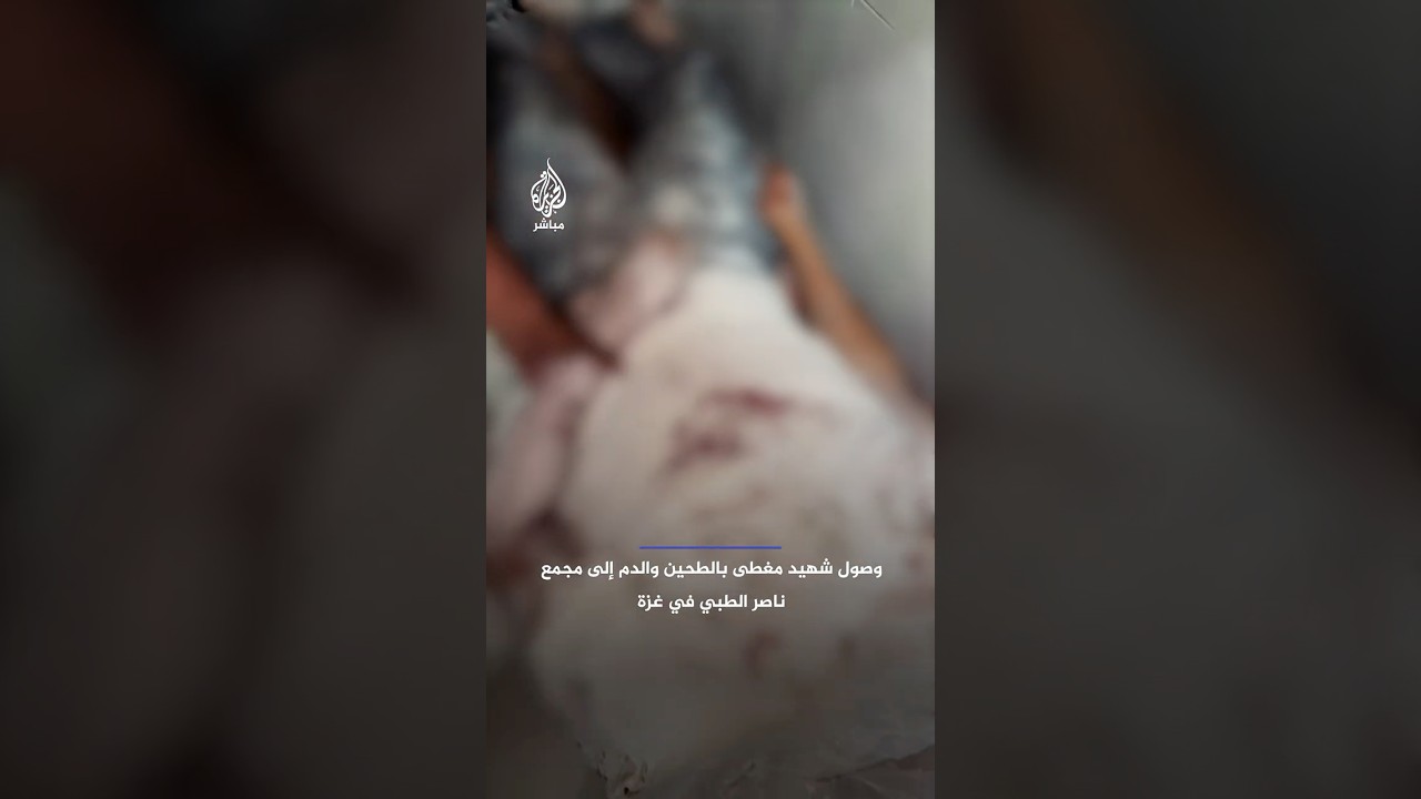 وصول شهيد مغطى بالطحين والدم إلى مجمع ناصر الطبي في غـ ـزة إثر مجزرة إسرائيلية بحق طالبي المساعدات