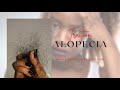 Traction Alopecia | Thinning hair | Hair loss Solution | Hair Regrowth | Hair loss treatment #hair