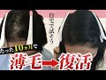 【薄毛も改善】正しい知識が薄毛の悩みを改善。自宅で出来る薄毛対策