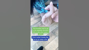 Trying to move my hand on my paralyzed arm #BrachialPlexusInjury #disability