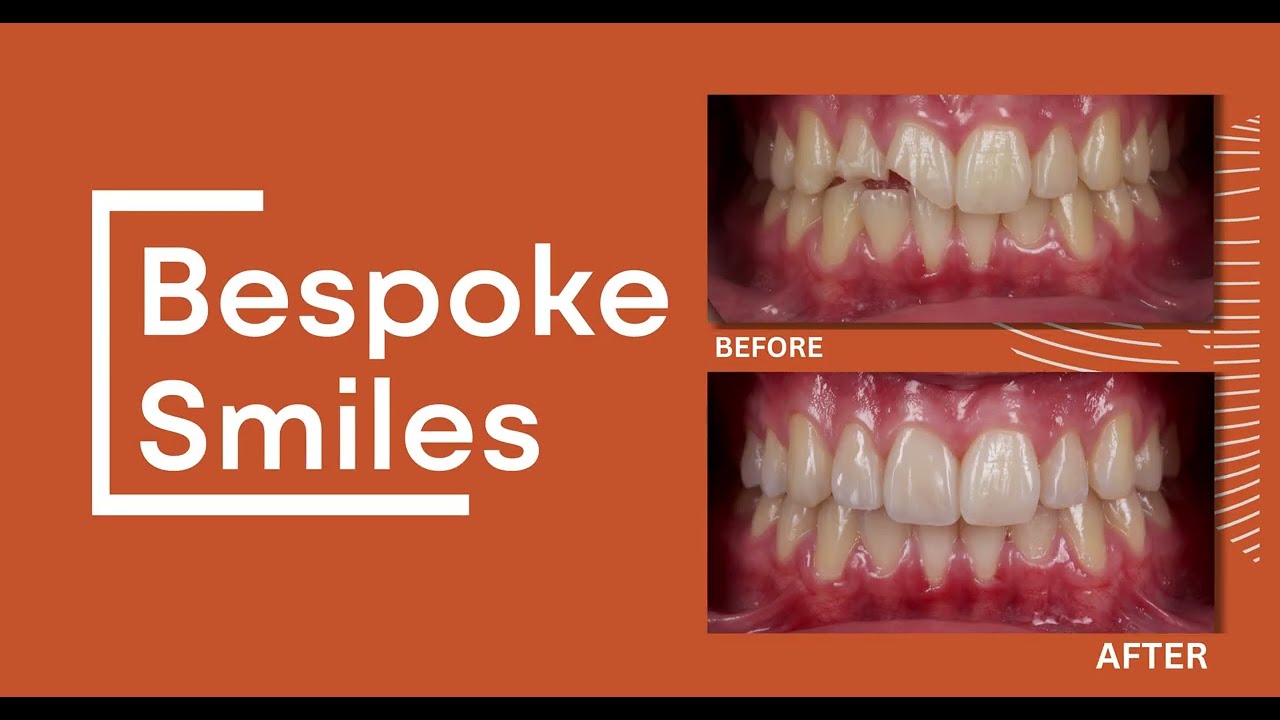 Revitalise - Jason Smithson (Cosmetic Dentistry)