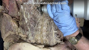 Spinal cord exposure 1