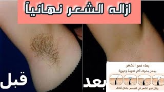 بديل الليزر ?ازاله_الشعرسويتليزر  ازالة_الشعر_الزائد_شعر_الجسم_شعر_المناطق_الحساسةروتين