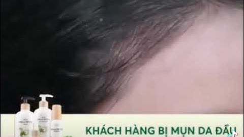 Dầu gội Amla Detox #laço . Hỗ trợ giảm rụng tóc và kích thích mọc tóc