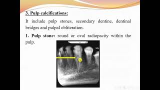 common dental diseases screenshot 2