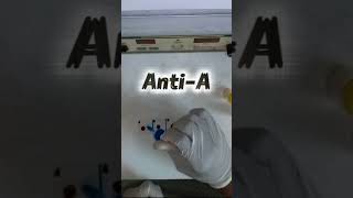 Blood Group Practical 🧪 Easy Trick!