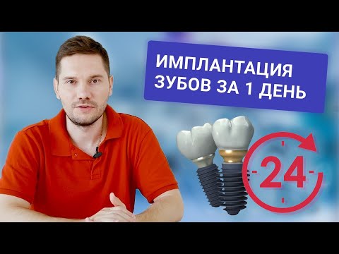 Имплантация зубов за 1 день