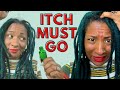 How to Get Rid of ITCHY SCALP with Locs