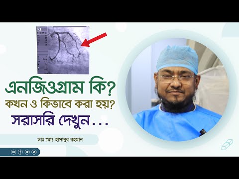 ভিডিও: এনজি নির্দেশাবলী কি?