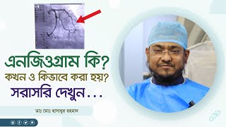 এনজিওগ্রাম কি? কখন ও কিভাবে করা হয়? সরাসরি দেখুন What is angiogram? When and how is it done?