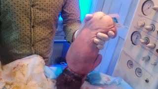 New born female baby came with no breath take action done suction baby cry thanks God🥰