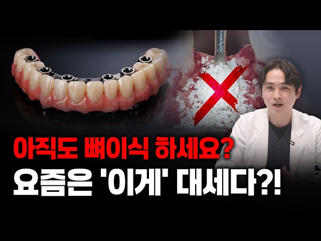 뼈이식 필요 없는 풀아치 임플란트는 '이런' 분들만 하세요!