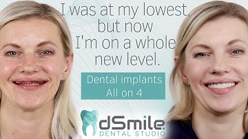 From Despair to Joy: How All on X Implants at dSmile Transformed Life