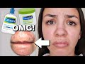 I Used Cetaphil Skincare For One Week!