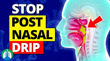 How do you stop post-nasal sinus drainage?