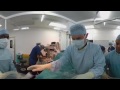 Diagnostic Laparoscopy