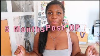 MY BBL JOURNEY: 5 Things YOU MUST DO After Surgery + 5 Months Post Op | angeliejb