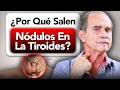 ¿Por Qué Salen Nódulos En La Tiroides?
