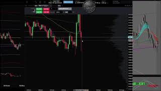 50 MA & VWAP "1 - Minute" SCALPING Trading Strategy - Fast Scalps on a 1 Minute 7/9/2021 Friday