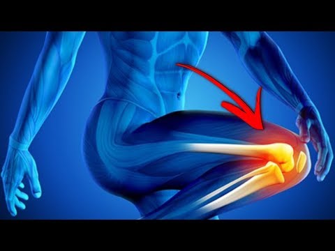 Vídeo: Descubra 5 Causas Comunes De Dolor Severo De Rodilla