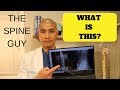 The Spine Guy - Reading and Understanding your Lumbar X-ray.