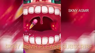 Asmr Hospital Tonsil Removal Animation Cause Of Bad Breath Video