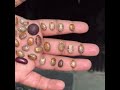Stress Relieving Sounds for a Healthier You Picking Ticks #ticktickpick #tick #usa 2026