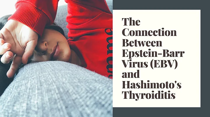 The Connection Between Epstein-Barr Virus (EBV) and Hashimoto's Thyroiditis