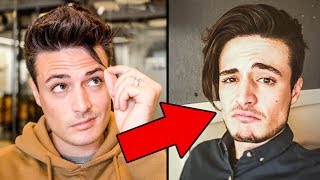 6 Months Mens Hair Growth Challenge Join Me Blumaan 2018