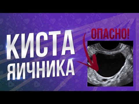 ОПАСНО! КИСТА ЯИЧНИКА! Чем грозит если не лечить?