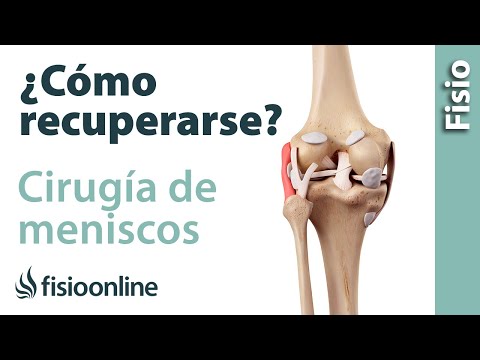 Vídeo: Com curar després de la cirurgia artroscòpica del genoll: 12 passos