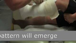 Wound Management - the correct way to apply a four layer bandage