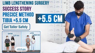 Gained 5.5 cm with Tibia Limb Lengthening / Precice 2