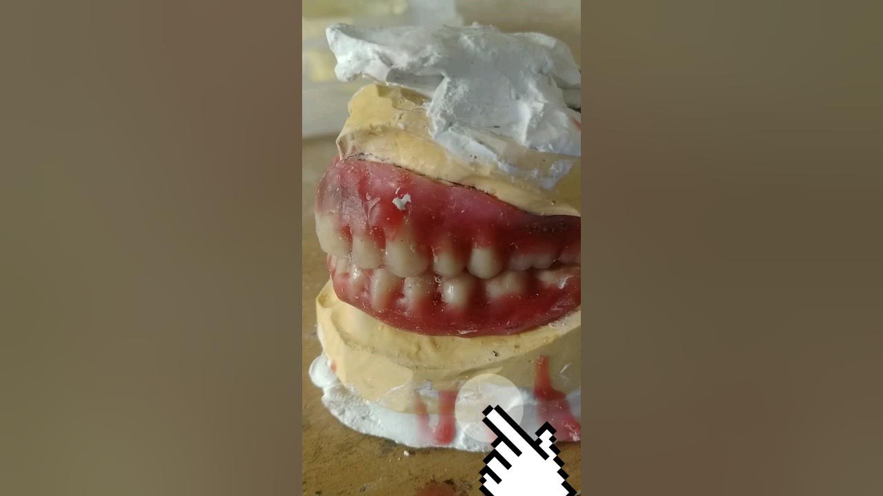 Duplicate Tooth shorts youtubeshorts viral tooth dental YouTube