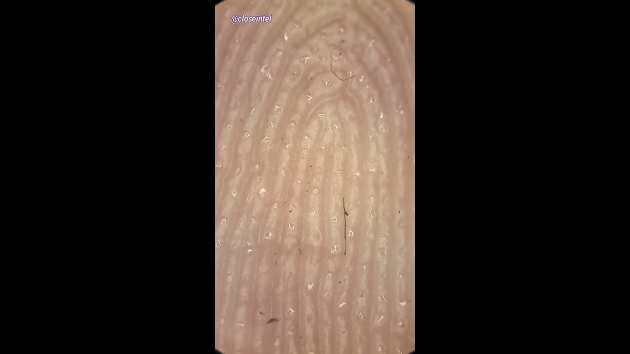 Sweaty Fingers Under Microscope