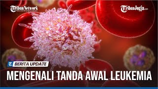 TANDA LEUKEMIA ATAU KANKER DARAH YANG PERLU DIWASPADAI