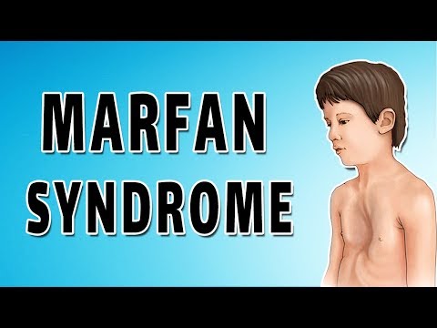 Marfan Syndrome - Causes, Symptoms, and Treatment