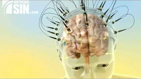 ¿Cómo afecta el ruido fuerte al cerebro?