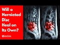 Will a Herniated Disc Heal on Its Own? (SURPRISING ANSWER)