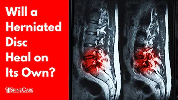Can a chiropractor make herniated disc worse?