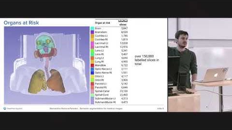 Bernardino Romera Peredes - Semantic segmentation for medical images