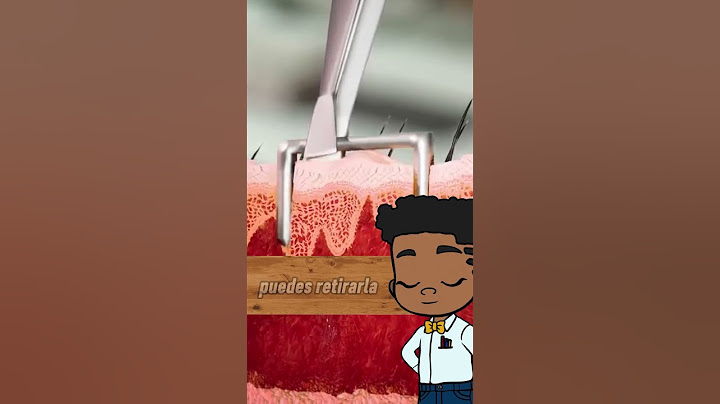 Como quitar una grapa de tu dedo 👉🏾.