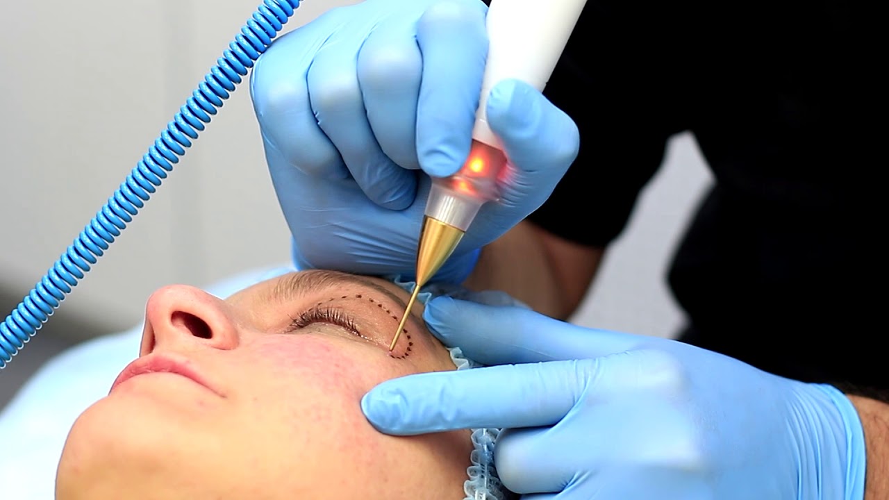 Александр Туркевич. Эффективная реабилитация после применения Jett Plasma Medical