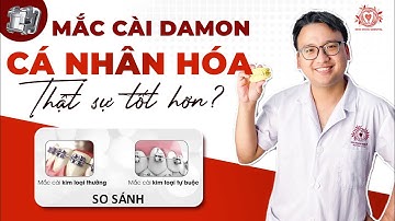 Vì Sao Mắc Cài Tự Buộc Damon Lại Điều Trị Cá Nhân Hóa Tốt Hơn! | Nha khoa Sdental