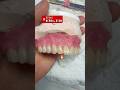 😮💨#dentist#parati#dentistry#dentalartistry#dental#dentaltechnician#shorts#yt#fyp#cesar