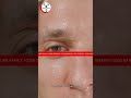 What To Do If Something Gets Into Your Eye | Quick Eye Safety Tips for Dust & Foreign Objects