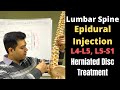 Spinal Injections for Lower Back Pain, Epidural Steroid Injection for Sciatica, Spine Injection