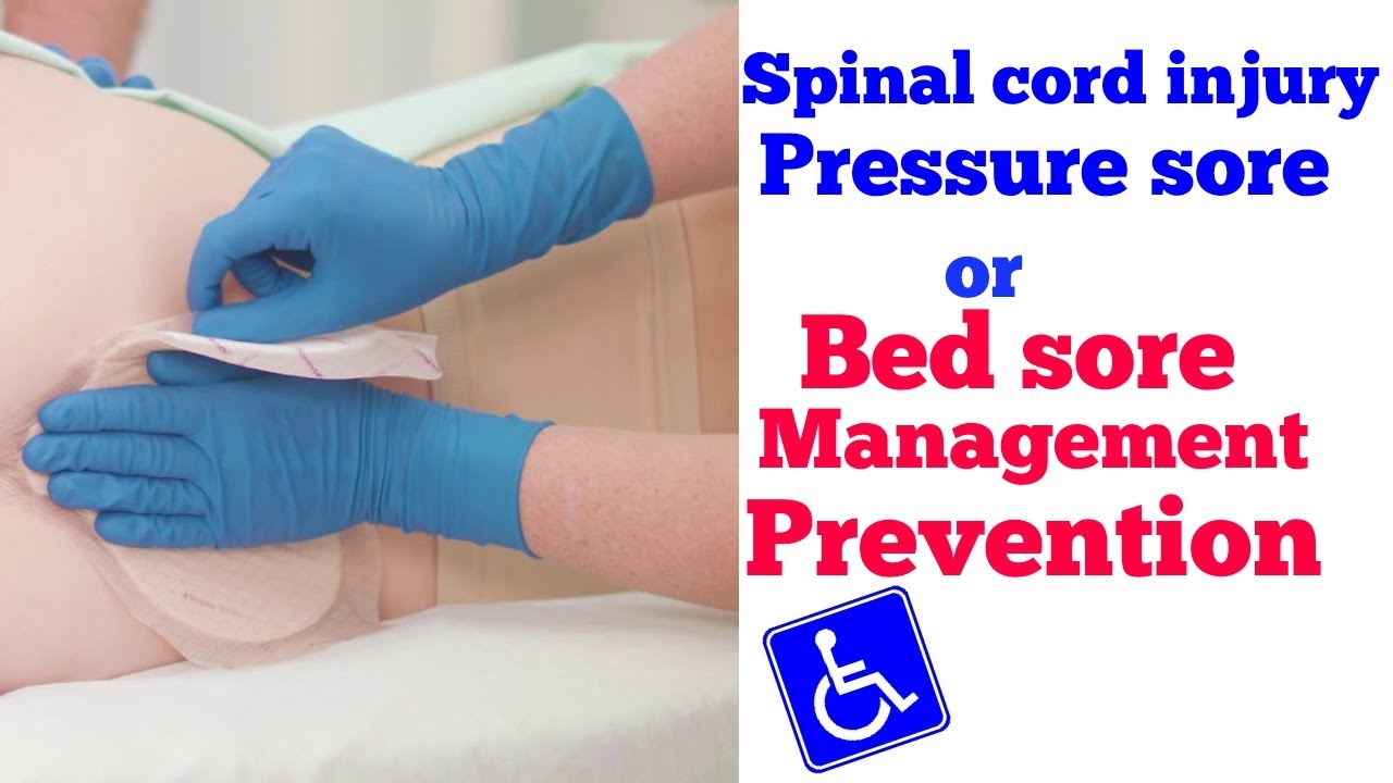 Pressure Sore Bed Sore Treatment And Prevention In Spinal Cord Injury