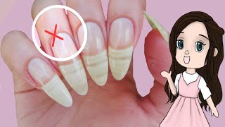 How To Heal Cuticles Overnight!✅ Nail Care Night Routine!🌙
